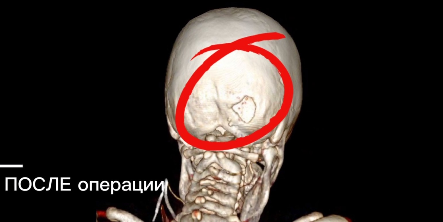emDIlh5x.jpg